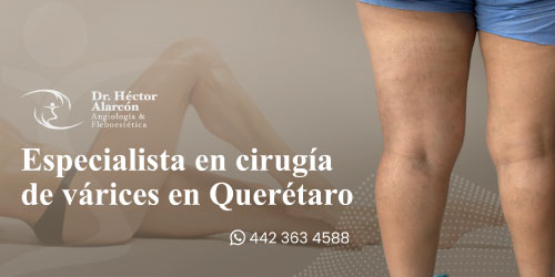 Especialista en Escleroterapia en Querétaro