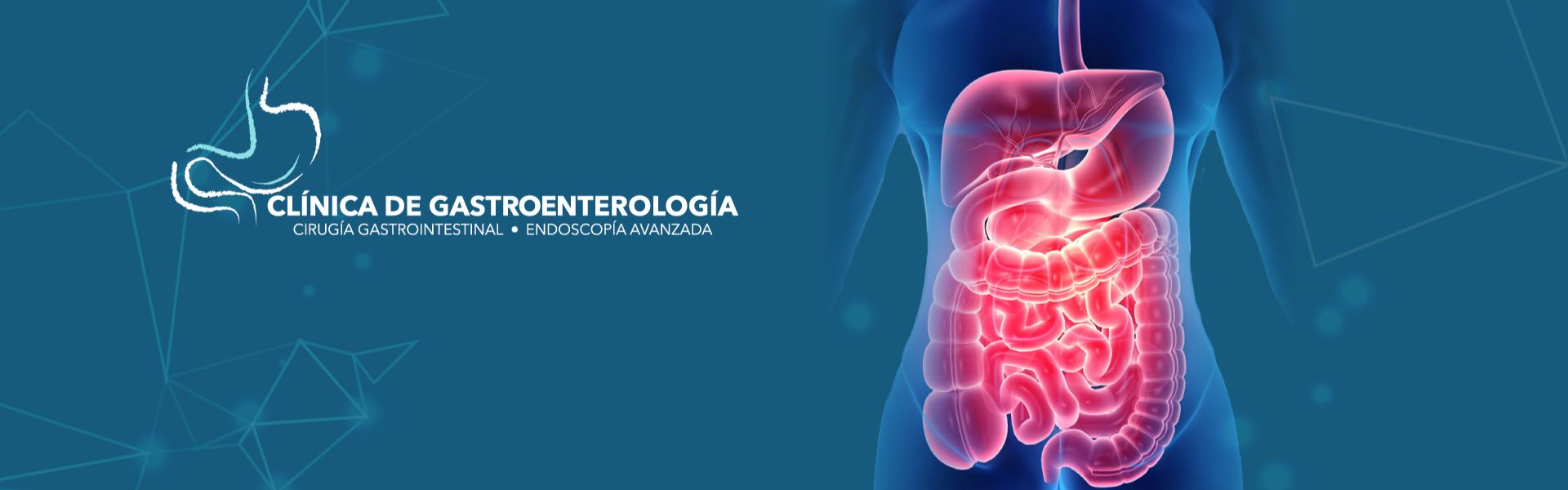 Cirugía Gastrointestinal en Querétaro ▷Dr. David San Marcos Romero